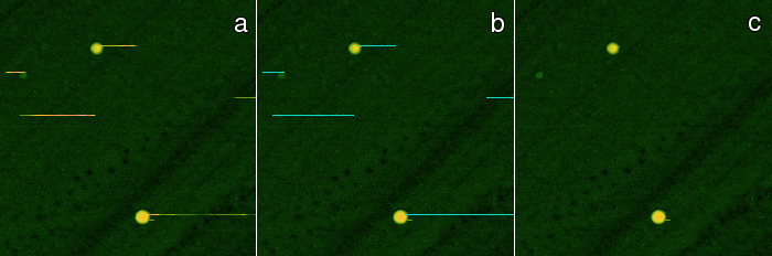 Scrars removal example